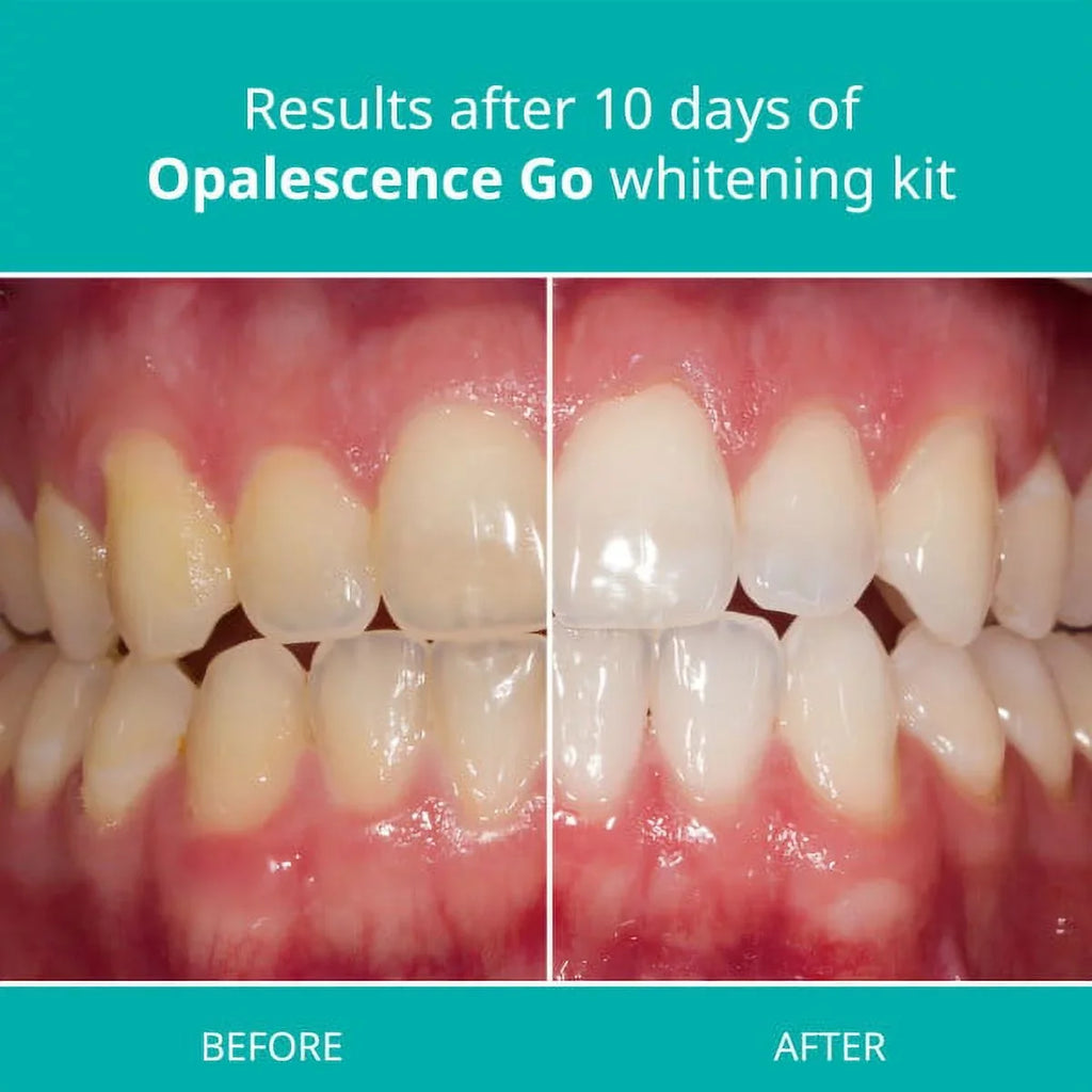 Opalescence Toothpaste And Opalescence Go 10% Mint Whitening Trays